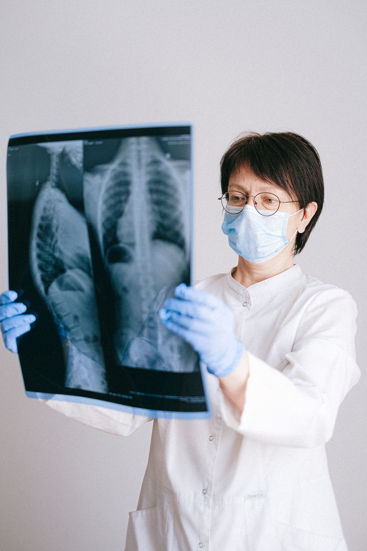 AI in Healthcare: Revolutionising Diagnosis and Treatment